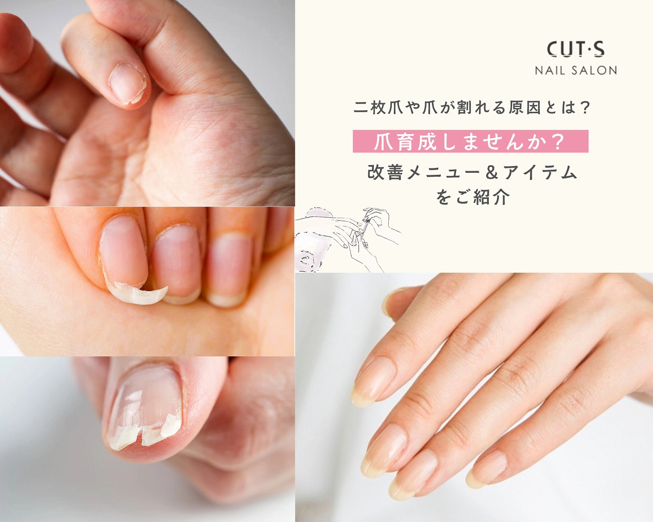 二枚爪や爪が割れる原因とケア方法をご紹介